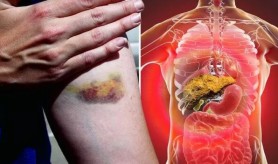 Leguma care ajută regenerarea ficatului. Este ideală pentru a trata ficatul gras