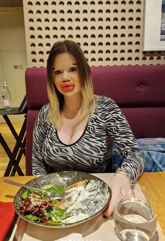 FOTO // Ea este femeia cu cele mai mari buze din lume. Are peste 40 de intervenții