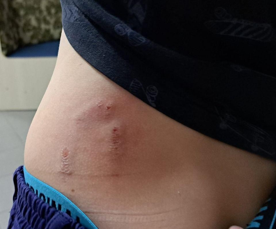 FOTO // Strigătul de durere al unei mame din Bălți: Copilul său de opt ani a fost atacat de o haită de câini