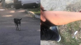 FOTO // La un pas de tragedie: Un maidanez a atacat un copil în sectorul Ciocana din Chișinău