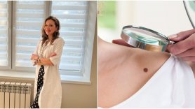 Ar trebui să ne îngrijoreze alunițele? Boala se poate vindeca dacă este depistată la timp
