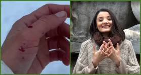 Lilu Ojovan, cu mâna de sânge: Nu am fost mușcată de câini din copilărie